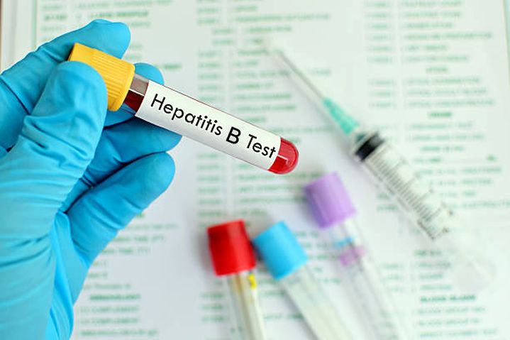 En Buenaventura la Hepatitis B se presenta más en las mujeres