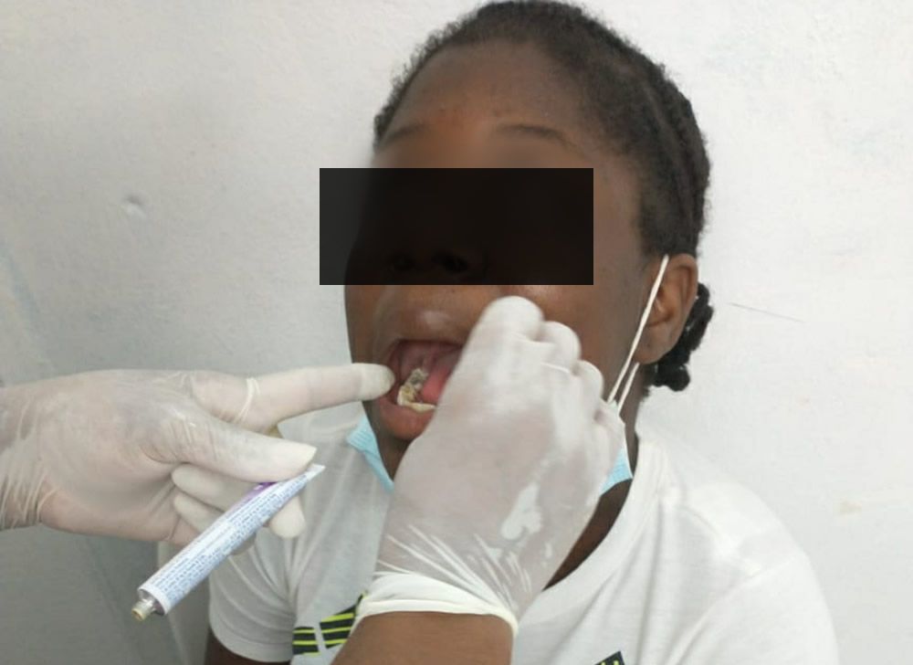 Habitantes del barrio El Jardín previenen caries y enfermedades bucales